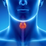 FNA thyroid